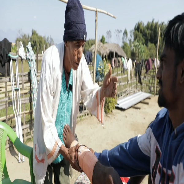 Adi man using traditional healing process Adi man using traditional healing process